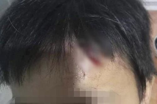Mẹ kế từng lãnh án vì bạo hành bé trai, nay tiếp tục bị nghi vấn bạo hành