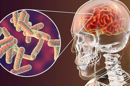 Vaccine ngừa viêm phổi mới