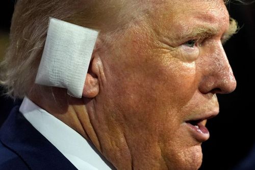 Ông Trump bị đạn hay mảnh đạn bắn trúng tai?