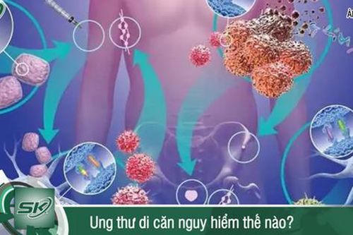 Ung thư di căn nguy hiểm thế nào?