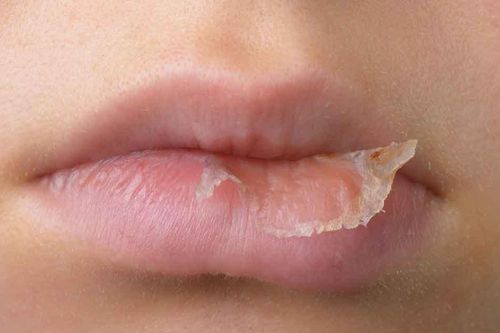 Mẹo tô son cho môi khô nẻ
