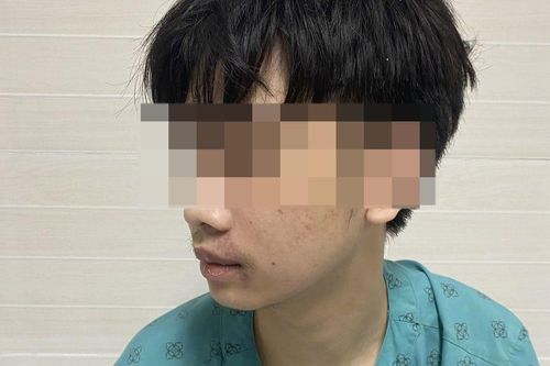 'Cầu cứu' bác sĩ sau hành vi thanh viên mới lớn thường làm