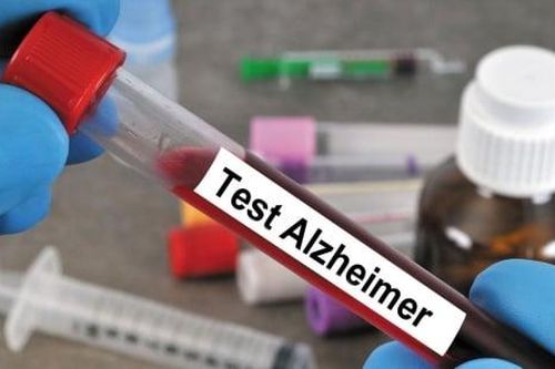 Phát hiện bệnh Alzheimer chính xác 90% nhờ cách làm đơn giản