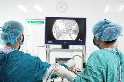 Đau tức bụng dưới, người phụ nữ 42 tuổi ở Phú Thọ đi khám bất ngờ phát hiện buồng trứng đa nang