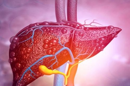 Ăn gỏi cá, cá nấu chưa chín dễ bị nhiễm sán lá gan nhỏ bạn đã biết chưa?