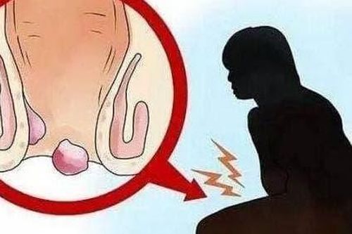 'Mười người đàn bà, chín người trĩ', phụ nữ nên tránh xa các bệnh về hậu môn trực tràng như thế nào?