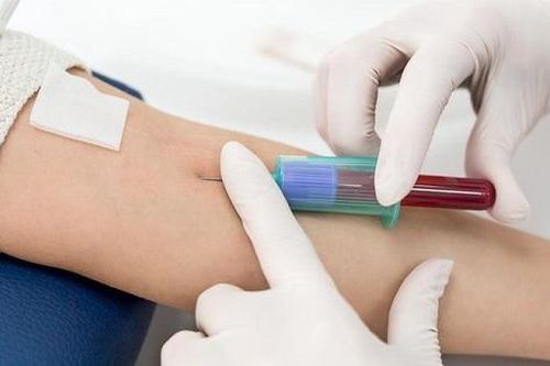 Những xét nghiệm máu nào không cần nhịn ăn?