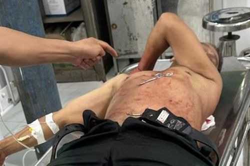 Bình Phước: Lời khai của kẻ giết người, quỵt tiền xe ôm
