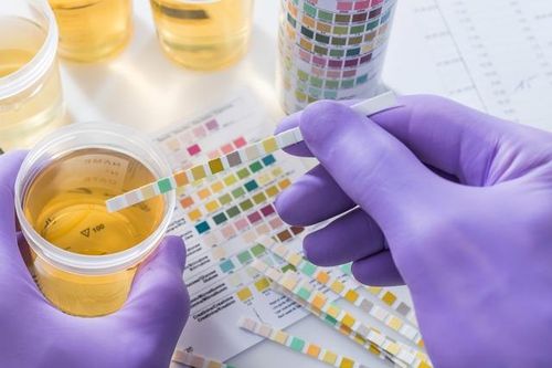 Xét nghiệm nước tiểu có phải nhịn ăn không?