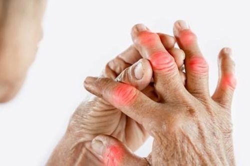 Ai có nguy cơ mắc viêm khớp dạng thấp?