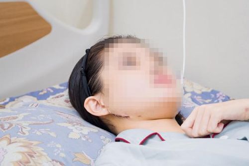 Người phụ nữ trẻ đi cấp cứu vì không há được miệng