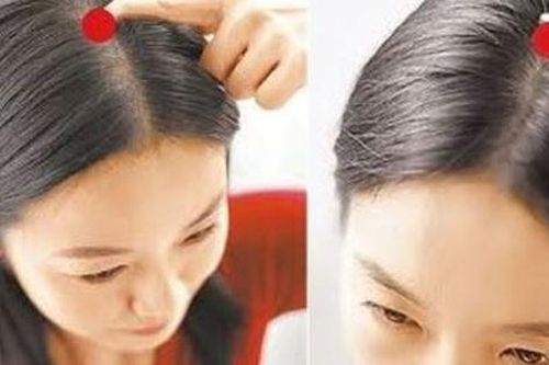 5 bài tập xoa bóp, bấm huyệt cho người bị nấm da đầu