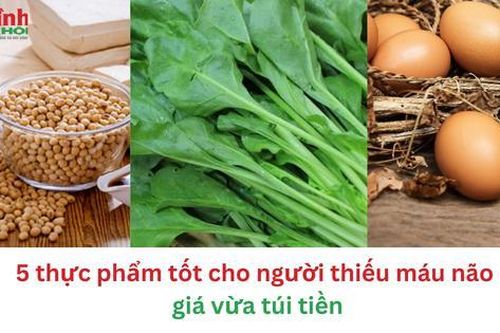 5 thực phẩm tốt cho người thiếu máu não giá vừa túi tiền