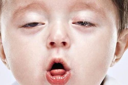 Ho đến kiệt sức, bé trai 1 tháng tuổi mắc căn bệnh nguy hiểm diễn biến âm thầm