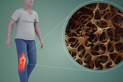 Để phòng loãng xương cần làm theo cách sau