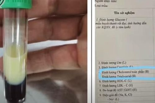 Đau bụng dữ dội, nguy kịch vì chỉ số mỡ máu cao gấp 50 lần người bình thường