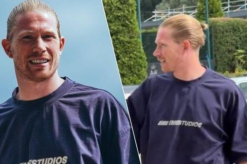 Diện mạo khác lạ của De Bruyne
