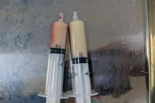 Người đàn ông đi cấp cứu với cơn đau bụng dữ dội