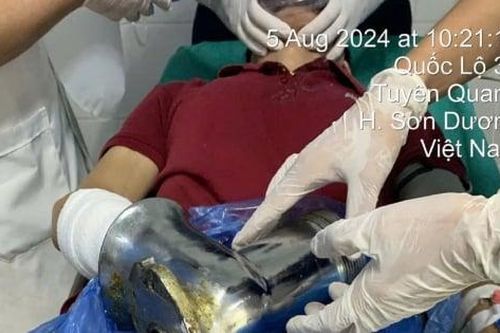 Người đàn ông bị dập nát bàn tay do máy xay thịt