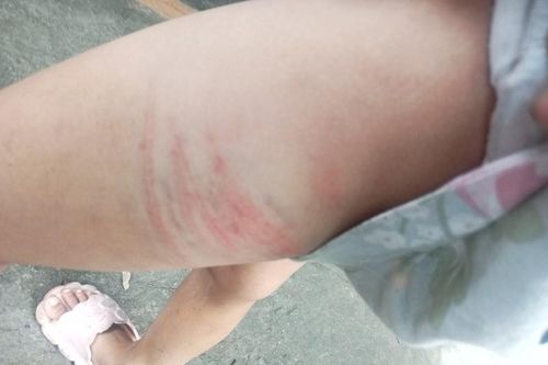 Bị bố bạo hành, bé gái nhắn tin lên tổng đài bảo vệ trẻ em