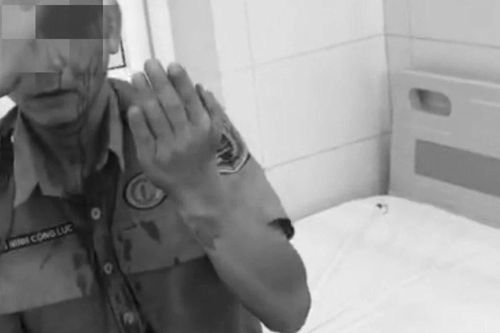 Bảo vệ Bệnh viện K bị 'cò nhà trọ' hành hung