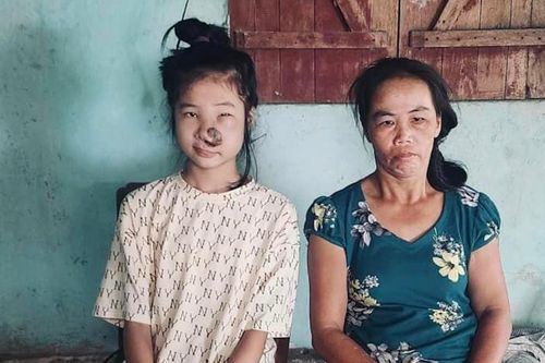 Mẹ tâm thần, bé gái 14 tuổi lại nhận tin bị ung thư