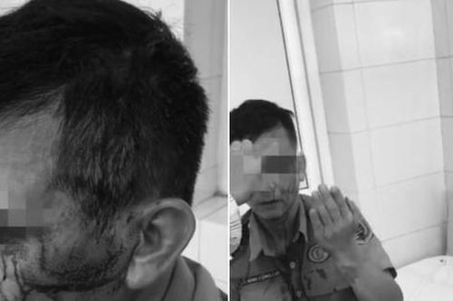 Công an 'vào cuộc' vụ bảo vệ Bệnh viện K bị 'cò bệnh viện' hành hung
