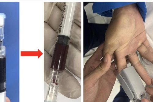 Chia sẻ thuốc quý hiếm cứu sống bệnh nhân bị ngộ độc nặng