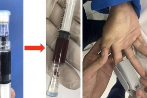 Các bệnh viện kịp thời chia sẻ thuốc hiếm, cứu 2 người bị ngộ độc hóa chất