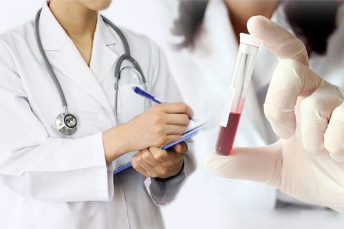 Một số điều cần biết khi xét nghiệm máu