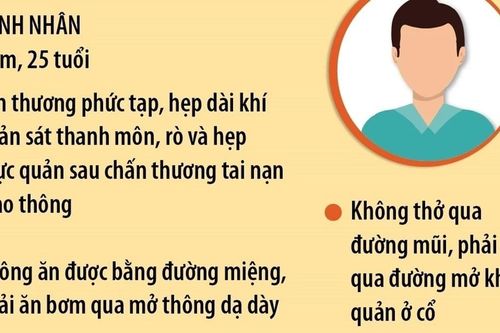 Thực hiện thành công ca ghép khí quản kết hợp tạo hình thực quản phức tạp