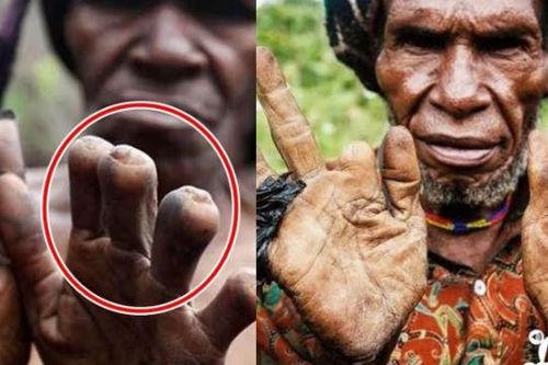 Bộ tộc có hủ tục rùng rợn: Phụ nữ phải cắt cụt ngón tay khi người nhà mất, càng thân thiết càng mất nhiều ngón!