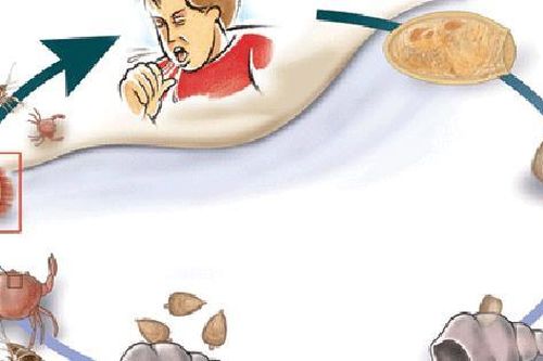 Nam thanh niên ở Sơn La thường xuyên ho ra máu từ thói quen nhiều người hay mắc phải