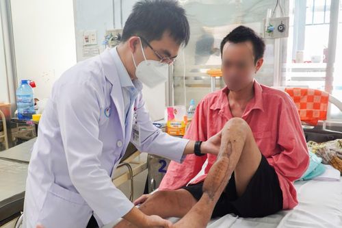 Bệnh nhân đầu tiên tại Việt Nam được áp dụng kỹ thuật ghép mảnh in 3D Titan dạng lưới