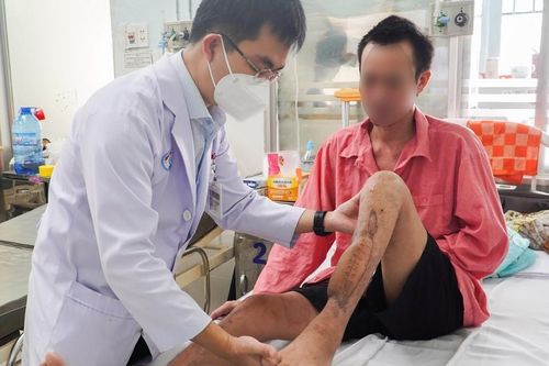 Người đàn ông mất xương chân có thể đi lại nhờ kỹ thuật lần đầu tiên áp dụng