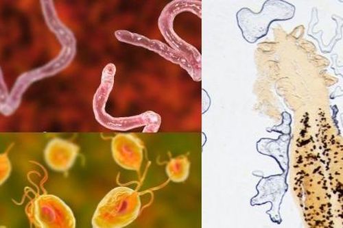 Ho ra máu cảnh giác với sán lá phổi