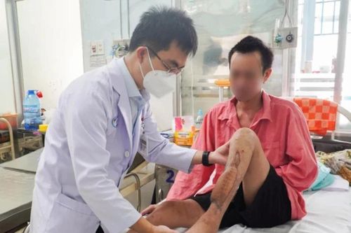 Đột phá công nghệ ghép xương 3D titan dạng lưới cho bệnh nhân gãy xương chày