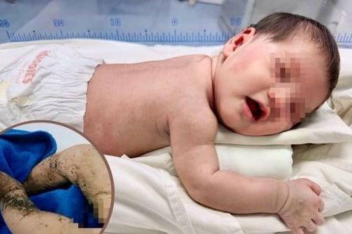 Phép màu đã đến với bé gái bị bỏ rơi, giòi bu khắp người
