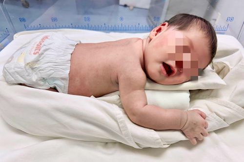 Bé sơ sinh bị bỏ rơi đã được nhận nuôi