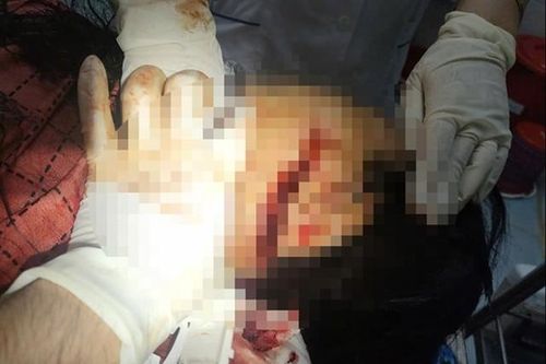 Chồng đánh vợ trọng thương rồi bỏ trốn