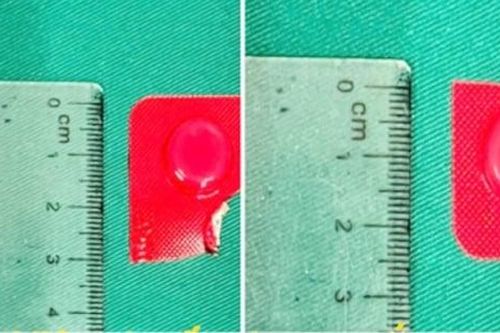 Uống thuốc còn nguyên vỏ, người đàn ông 54 tuổi nhập viện cấp cứu gấp