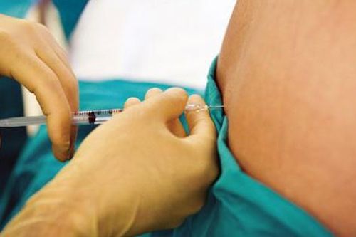 Các biện pháp điều trị chèn ép dây thần kinh thẹn