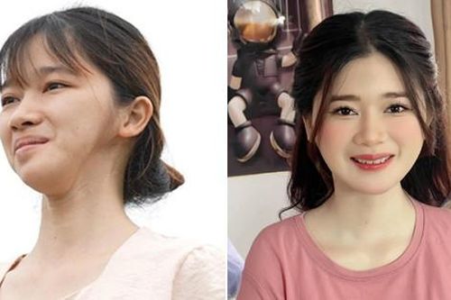 Từng bị bạn học đánh vì gương mặt lạ, cô gái Ninh Bình 'lột xác' ngỡ ngàng