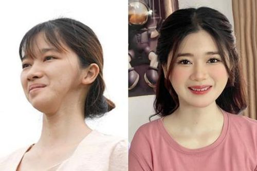 Từng bị bạn học bạo hành vì xấu xí, cô gái lột xác ngoạn mục khiến ai cũng bất ngờ