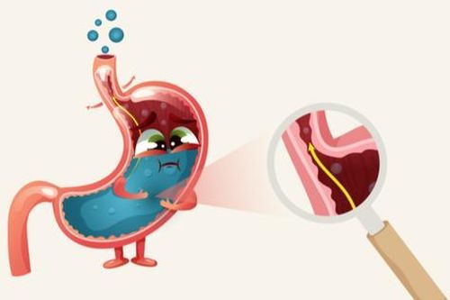 Hậu quả nguy hiểm đến sức khỏe khi bị trào ngược dạ dày – thực quản