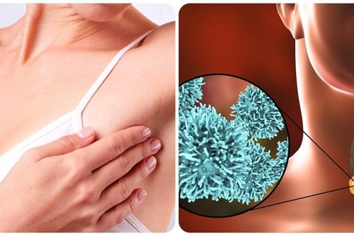 7 loại ung thư có khả năng chữa khỏi nếu phát hiện sớm