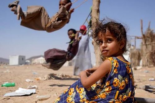 Hơn nửa triệu trẻ em Yemen suy dinh dưỡng cấp tính