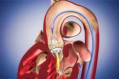 Chờ kết luận từ Hội đồng chuyên môn về ca tử vong ở Đắk Lắk liên quan 3 bác sĩ BV Bạch Mai