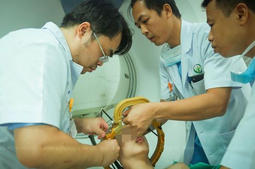 Lần đầu tiên phẫu thuật kích thích não sâu cho bệnh nhân rối loạn trương lực cơ