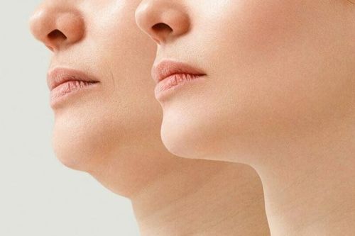 Bài tập giúp bạn thoát tình trạng cằm đôi khó chịu